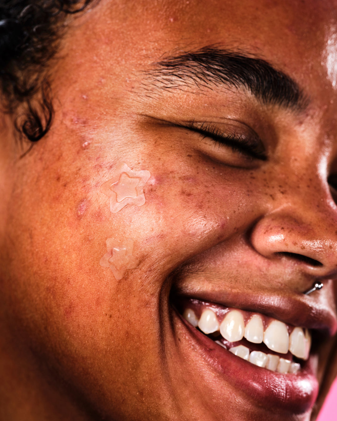 Laughing model wears two invisible Hydro-Star® Clear hydrocolloid pimple patches on their cheek. One star is larger than the other.
